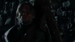 extant_GameOfThrones_1x10-FireAndBlood_1655