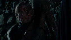 extant_GameOfThrones_1x10-FireAndBlood_1689