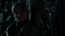 extant_GameOfThrones_1x10-FireAndBlood_1692