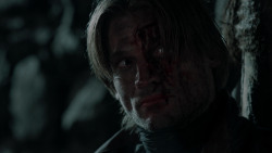 extant_GameOfThrones_1x10-FireAndBlood_1786
