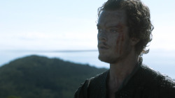 extant_GameOfThrones_3x03-WalkOfPunishment_4471