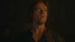 extant_GameOfThrones_3x04-AndNowHisWatchIsEnded_2271
