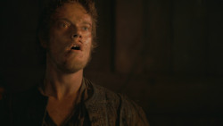 extant_GameOfThrones_3x04-AndNowHisWatchIsEnded_2273