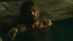 extant_GameOfThrones_3x04-KissedByFire_3731