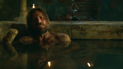 extant_GameOfThrones_3x04-KissedByFire_3784