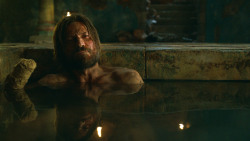 extant_GameOfThrones_3x04-KissedByFire_3785