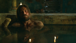 extant_GameOfThrones_3x04-KissedByFire_3786