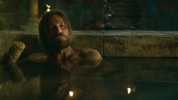 extant_GameOfThrones_3x04-KissedByFire_3793