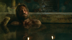 extant_GameOfThrones_3x04-KissedByFire_3795