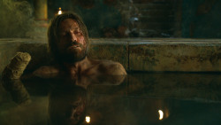 extant_GameOfThrones_3x04-KissedByFire_3796