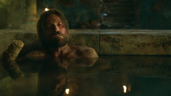 extant_GameOfThrones_3x04-KissedByFire_3797