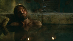 extant_GameOfThrones_3x04-KissedByFire_3810