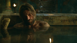 extant_GameOfThrones_3x04-KissedByFire_3821