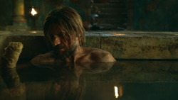 extant_GameOfThrones_3x04-KissedByFire_3825