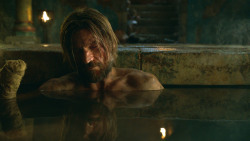 extant_GameOfThrones_3x04-KissedByFire_3849