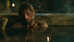 extant_GameOfThrones_3x04-KissedByFire_3850