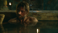 extant_GameOfThrones_3x04-KissedByFire_3877
