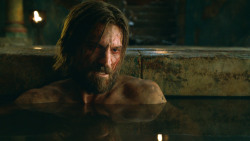 extant_GameOfThrones_3x04-KissedByFire_3983