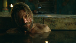 extant_GameOfThrones_3x04-KissedByFire_4205
