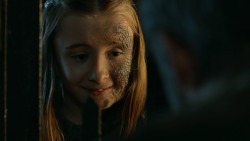 extant_GameOfThrones_3x04-KissedByFire_4363