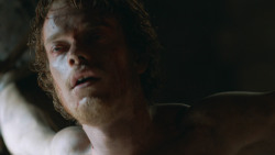 extant_GameOfThrones_3x05-TheClimb_2240