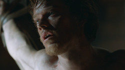extant_GameOfThrones_3x05-TheClimb_2400