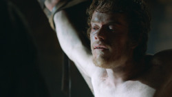 extant_GameOfThrones_3x05-TheClimb_2490
