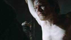 extant_GameOfThrones_3x05-TheClimb_2526