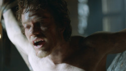 extant_GameOfThrones_3x05-TheClimb_2714