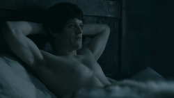extant_GameOfThrones_5x05-KillTheBoy_1903