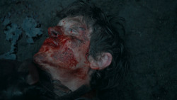 extant_GameOfThrones_6x09-BattleOfTheBastards_5597