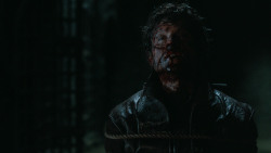 extant_GameOfThrones_6x09-BattleOfTheBastards_5809