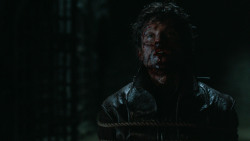 extant_GameOfThrones_6x09-BattleOfTheBastards_5816
