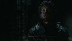 extant_GameOfThrones_6x09-BattleOfTheBastards_5818
