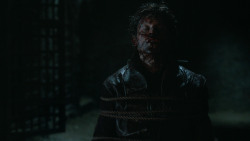 extant_GameOfThrones_6x09-BattleOfTheBastards_5854