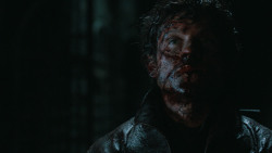 extant_GameOfThrones_6x09-BattleOfTheBastards_6012