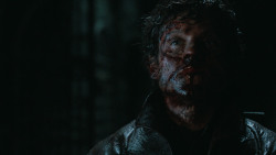 extant_GameOfThrones_6x09-BattleOfTheBastards_6013