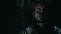 extant_GameOfThrones_6x09-BattleOfTheBastards_6015