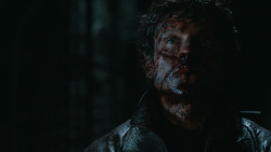 extant_GameOfThrones_6x09-BattleOfTheBastards_6016