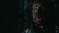 extant_GameOfThrones_6x09-BattleOfTheBastards_6024