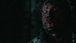 extant_GameOfThrones_6x09-BattleOfTheBastards_6025